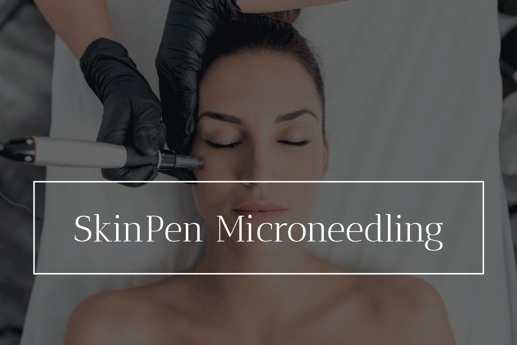 Microneedling Aesthetic Services Denver